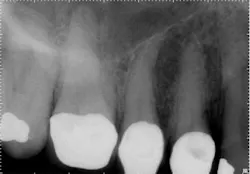 15jan20endolandwehr05 15jan20endolandwehr05