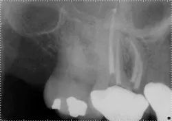 15jan20endolandwehr06 15jan20endolandwehr06