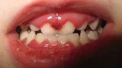 14junesimmonsaphg01 14junesimmonsaphg01