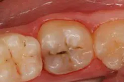 2014blank3mscotchbondselfetch01 2014blank3mscotchbondselfetch01