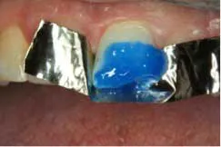 2014blank3mscotchbondtotaletch03 2014blank3mscotchbondtotaletch03