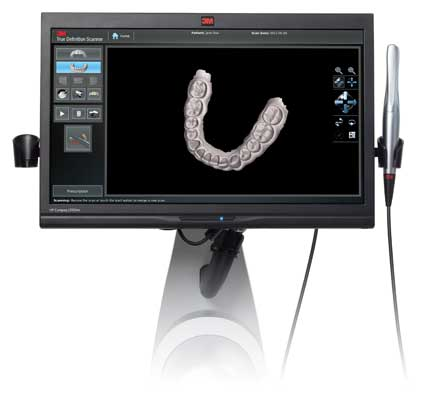 3mespe True Definition Scanner Es