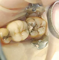 Apr112013 Gottlieb Fig1 Apr112013 Gottlieb Fig1