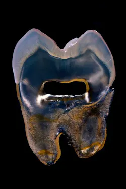 Blue Tooth Blue Tooth