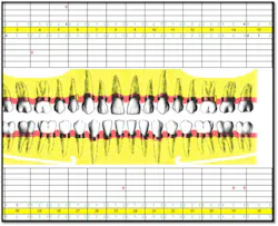 Cs2 Pocket Reduction Fo Cs2 Pocket Reduction Fo