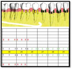 Cs2 Pretx2 Fo Cs2 Pretx2 Fo