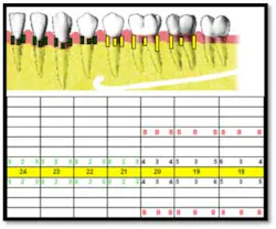 Cs2 Pretx6 Fo Cs2 Pretx6 Fo