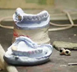 Dental Lab Pickett Dental Lab Pickett