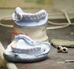 Dental Lab Pickett Dental Lab Pickett