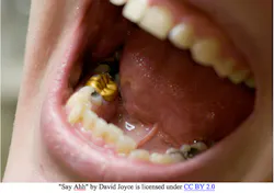 Dental Office Waste Dental Office Waste