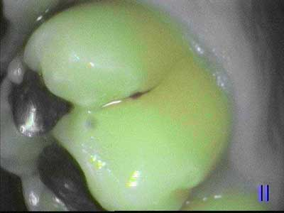 Salierno Soprolife May2014