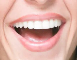 Shakira Smile Shakira Smile