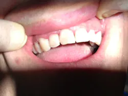 Soldierafter1 Soldierafter1