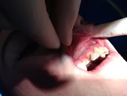 Soldierbefore1 Soldierbefore1