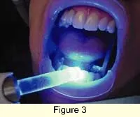 Th 0301dem024fig3 Th 0301dem024fig3