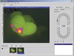 Th 0506dem Caries04 Th 0506dem Caries04