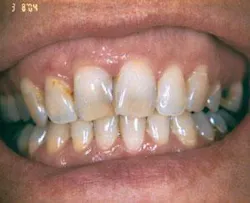 Th 0507wdjcer01 Th 0507wdjcer01