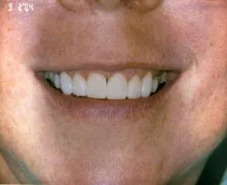 Th 0507wdjcer04 Th 0507wdjcer04