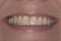 Th 0507wdjivo01 Th 0507wdjivo01