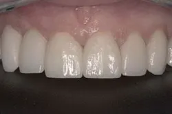 Th 0507wdjivo05 Th 0507wdjivo05