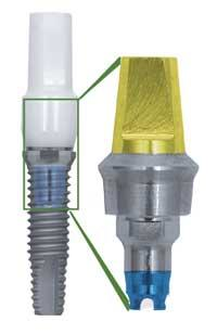 Th 0509dem Focusprod01