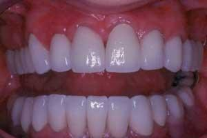 Th 0509dem Tipsfrom01