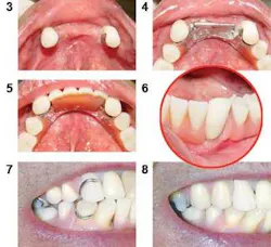 Th 0603dem Tips03 08 Th 0603dem Tips03 08