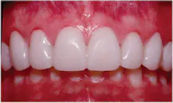 Th 0603wdjbra1 Th 0603wdjbra1