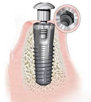 Th 0609dem Growingpop01