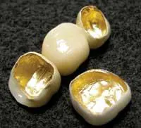 Th Precisionceramgoldplting Th Precisionceramgoldplting