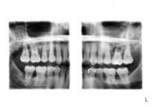 Travaendospecneeds01