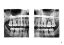 Travaendospecneeds01 Travaendospecneeds01