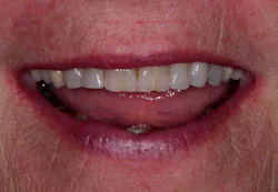 Ross Photog Fig10 Ross Photog Fig10