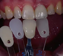 Ross Photog Fig15 Ross Photog Fig15