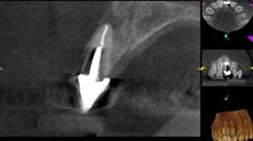 Content Dam Diq Online Articles 2016 02 16feb04bc Mccormack Article Thumbnail