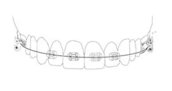 Figure 3: 2x4 appliance Figure 3: 2x4 appliance