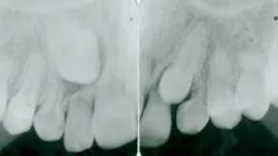 Content Dam Diq Online Articles 2016 03 16mar03bc Morneau Article Thumb Content Dam Diq Online Articles 2016 03 16mar03bc Morneau Article Thumb