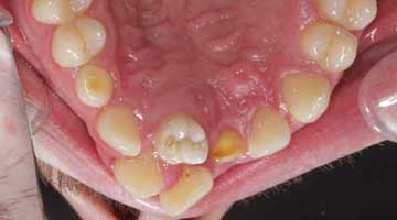 Content Dam Diq Online Articles 2016 03 16mar03bcsimmonsednt