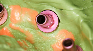 Content Dam Diq Online Articles 2016 03 Dental Implant Impression 1