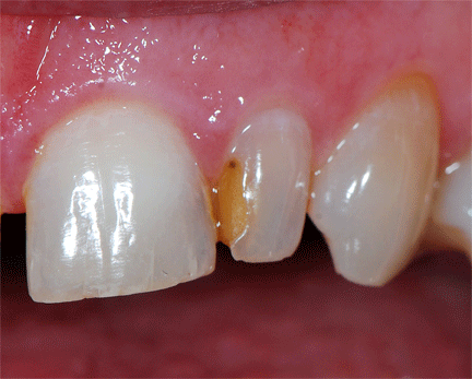 Content Dam Diq Online Articles 2016 03 Kurtzman Failing Fig01