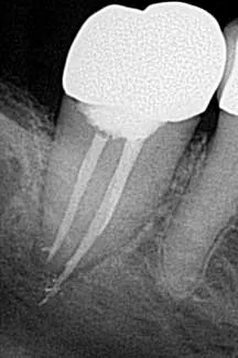 16apr7bcsimmons05 16apr7bcsimmons05