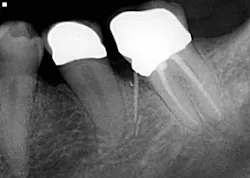 16apr7bcsimmons06 16apr7bcsimmons06