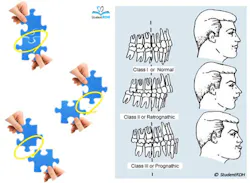 Occlusionmsh Occlusionmsh