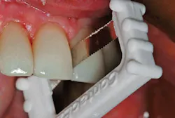 Contacez Acp Fig2 Contacez Acp Fig2