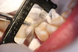 Content Dam Diq Online Articles 2016 06 Contacez Acp Fig1 Content Dam Diq Online Articles 2016 06 Contacez Acp Fig1