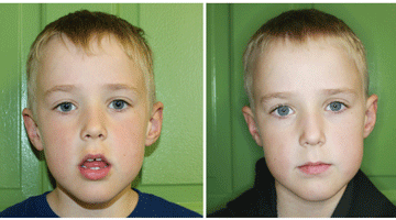 Content Dam Diq Online Articles 2016 06 Oral Rest Posture Thumb