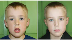 Content Dam Diq Online Articles 2016 06 Oral Rest Posture Thumb Content Dam Diq Online Articles 2016 06 Oral Rest Posture Thumb