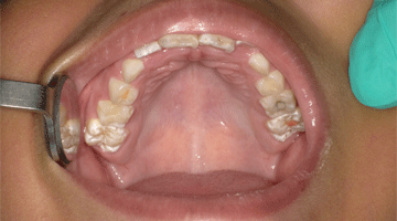 Content Dam Diq Online Articles 2016 07 Pmm Novy Sdf Diqthumb