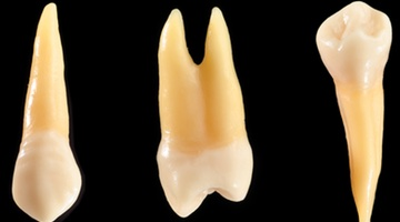 Content Dam Diq Online Articles 2016 08 Tooth Root Thumb