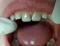 Heroic Dent Leigh02 Heroic Dent Leigh02